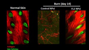 Imaging of burns indicates that those treated with the FL2 inhibitor nanotechnology experienced collagen deposition and hair follicle formation. (2-photo confocal microscopy) Credit: Vera DesMarais/Albert Einstein College of Medicine 