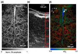 Fast functional photoacoustic microscopy of the mouse brain